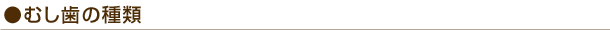 むし歯の種類