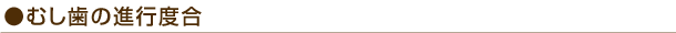むし歯の進行度合